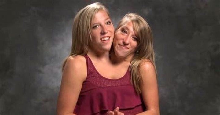 Conjoined Twins Abby and Brittany Hensel Now Work as Teachers |