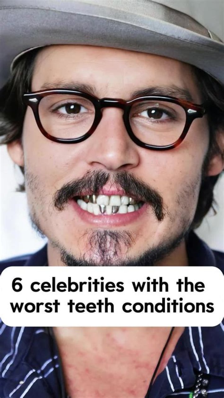 Discover The Surprising Truth About Actors With The Worst Teeth