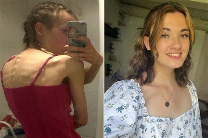 Hannah Murray's Health Has Fans Worried After Anorexia -What's Happened To Her?