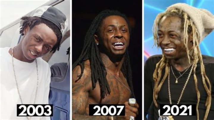 Has Lil Wayne Done Face Lift Surgery? ·