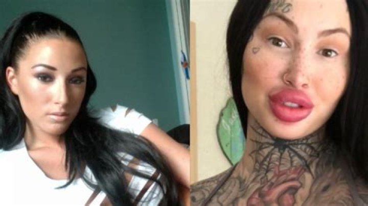 Mary Magdalene Model Before and After Surgery: Meet Her On Instagram