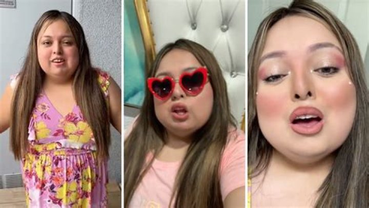 What Disability Does Shawty Bae Have? The Inspiring Story of a TikTok Star